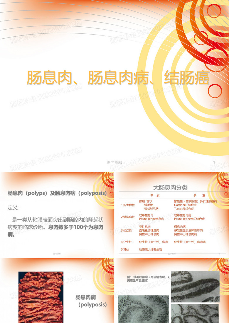 《外科学》肠息肉、肠息肉病、结肠癌  ppt课件