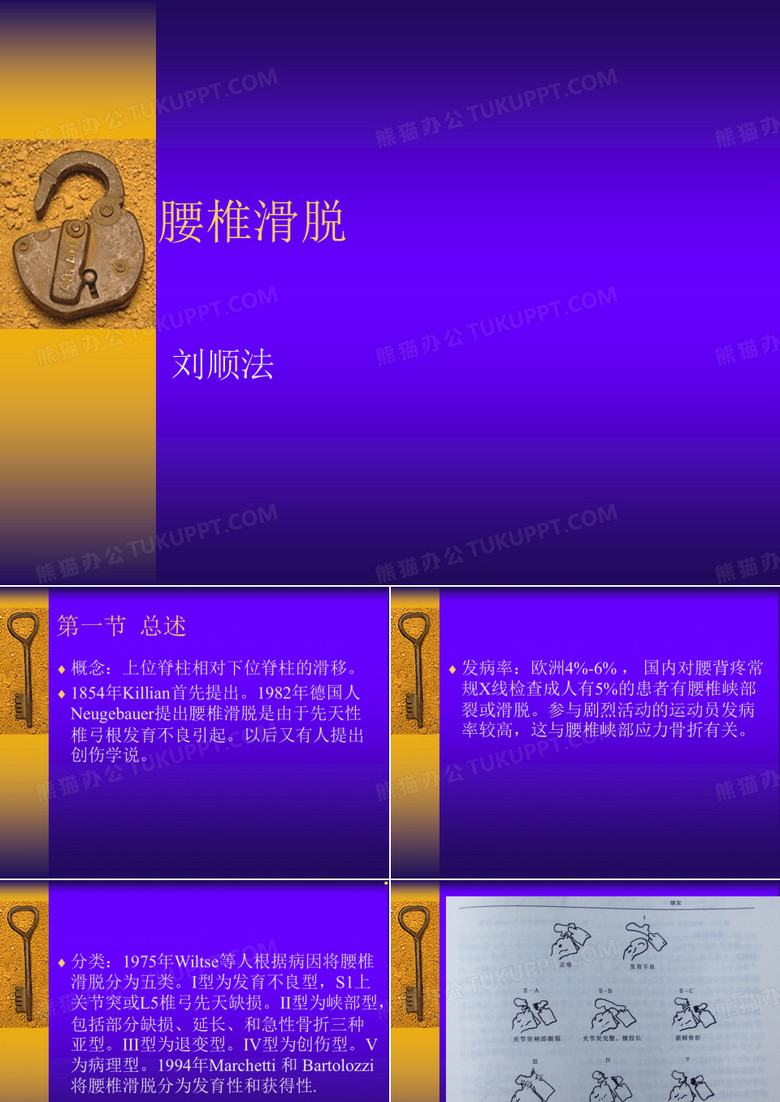 腰椎滑脱