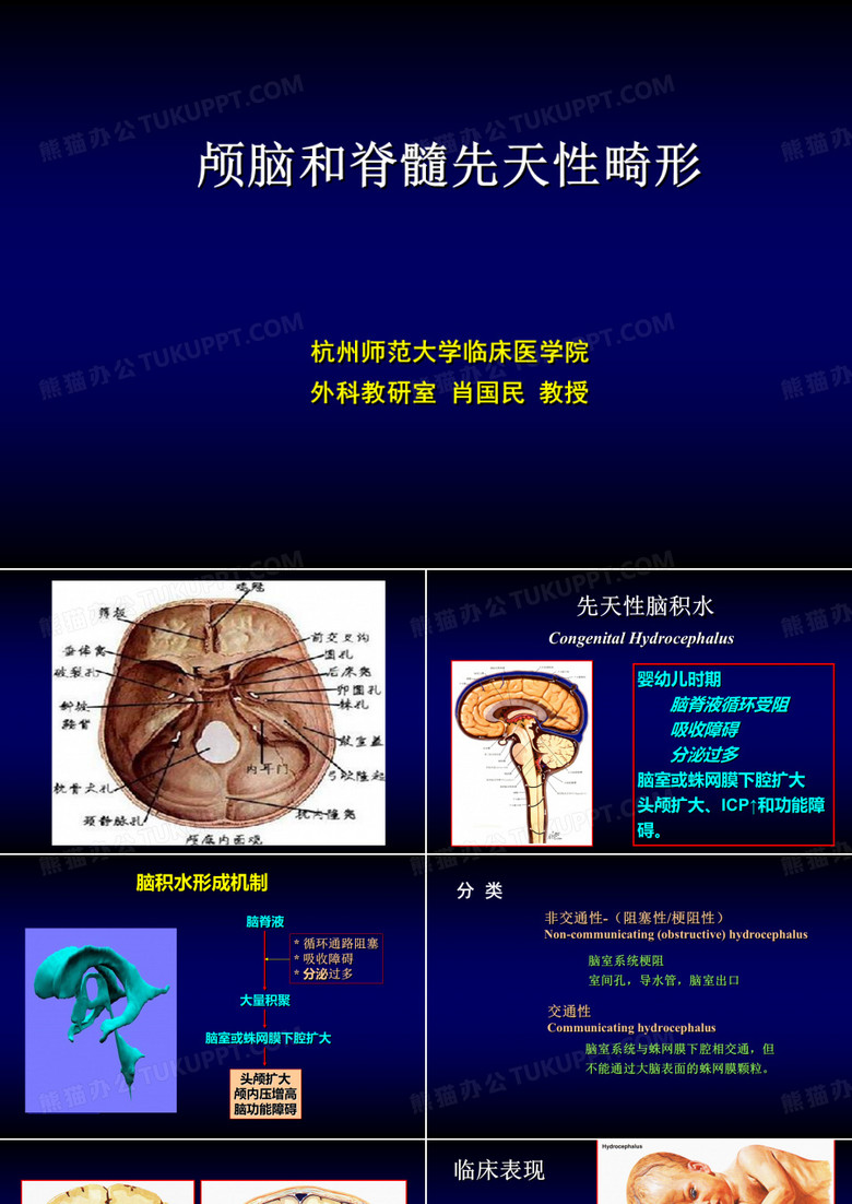 脑积水