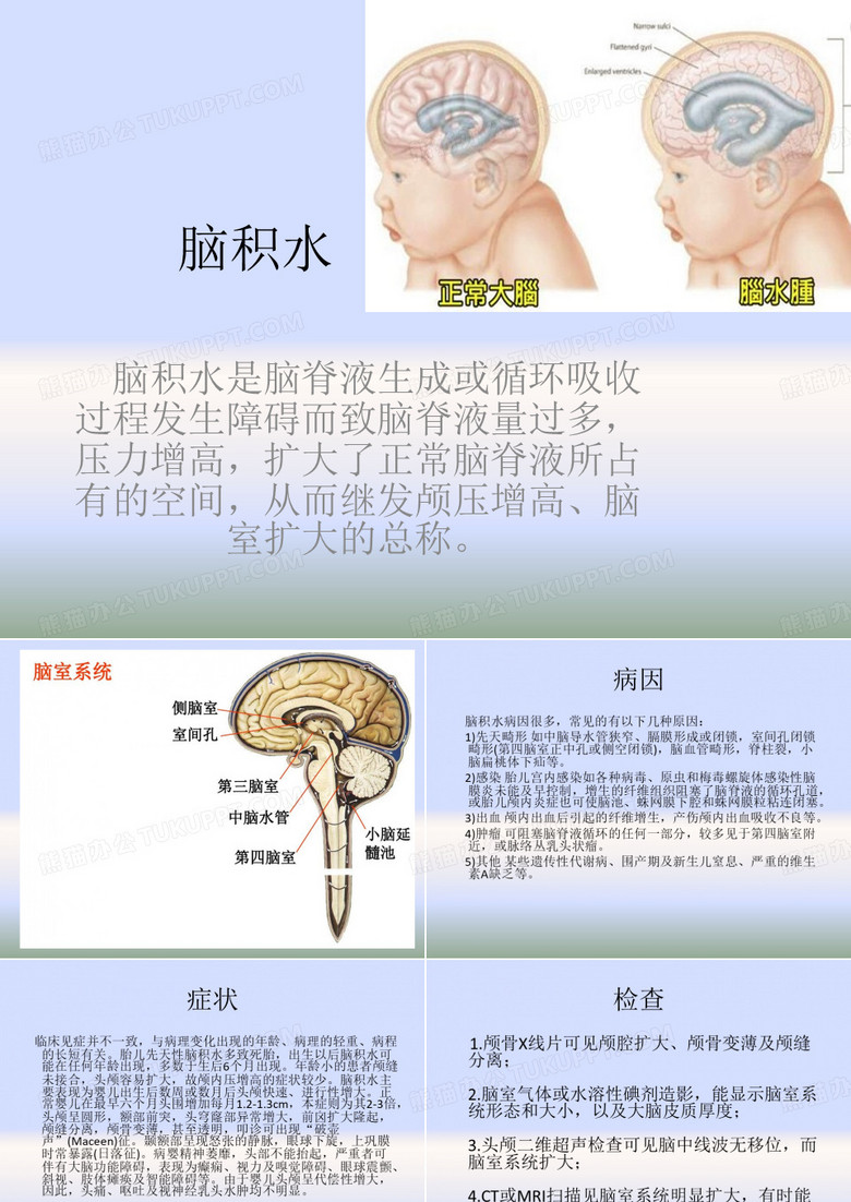 脑积水PPT