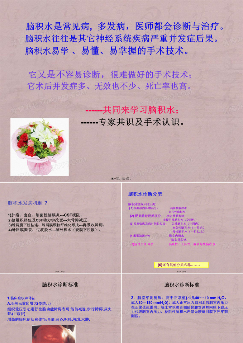 脑积水-讲稿