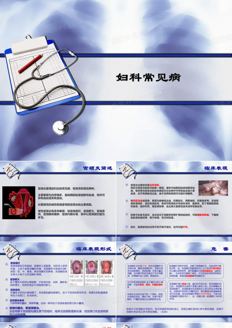 宫颈炎