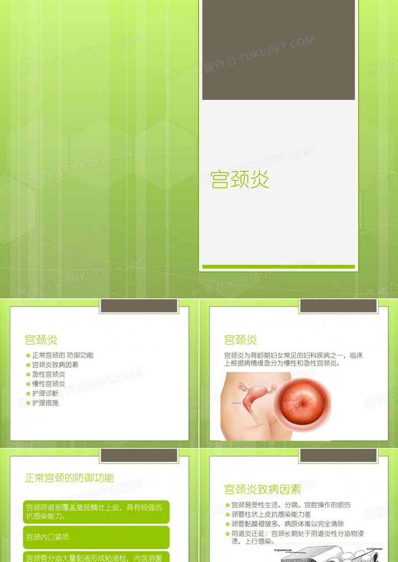 宫颈炎1