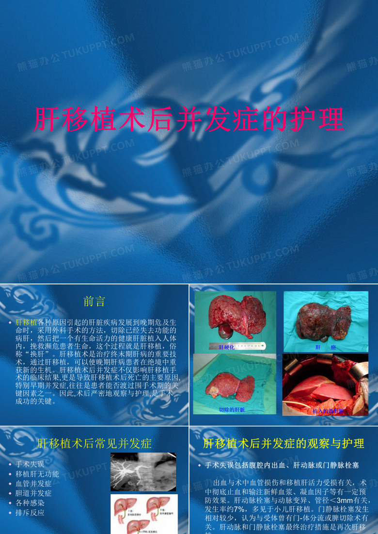 肝移植