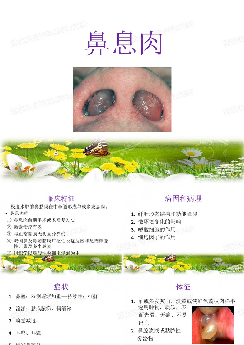 鼻息肉