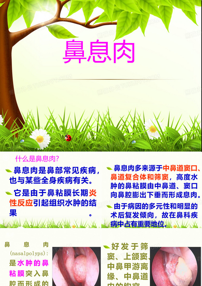 鼻息肉  ppt课件