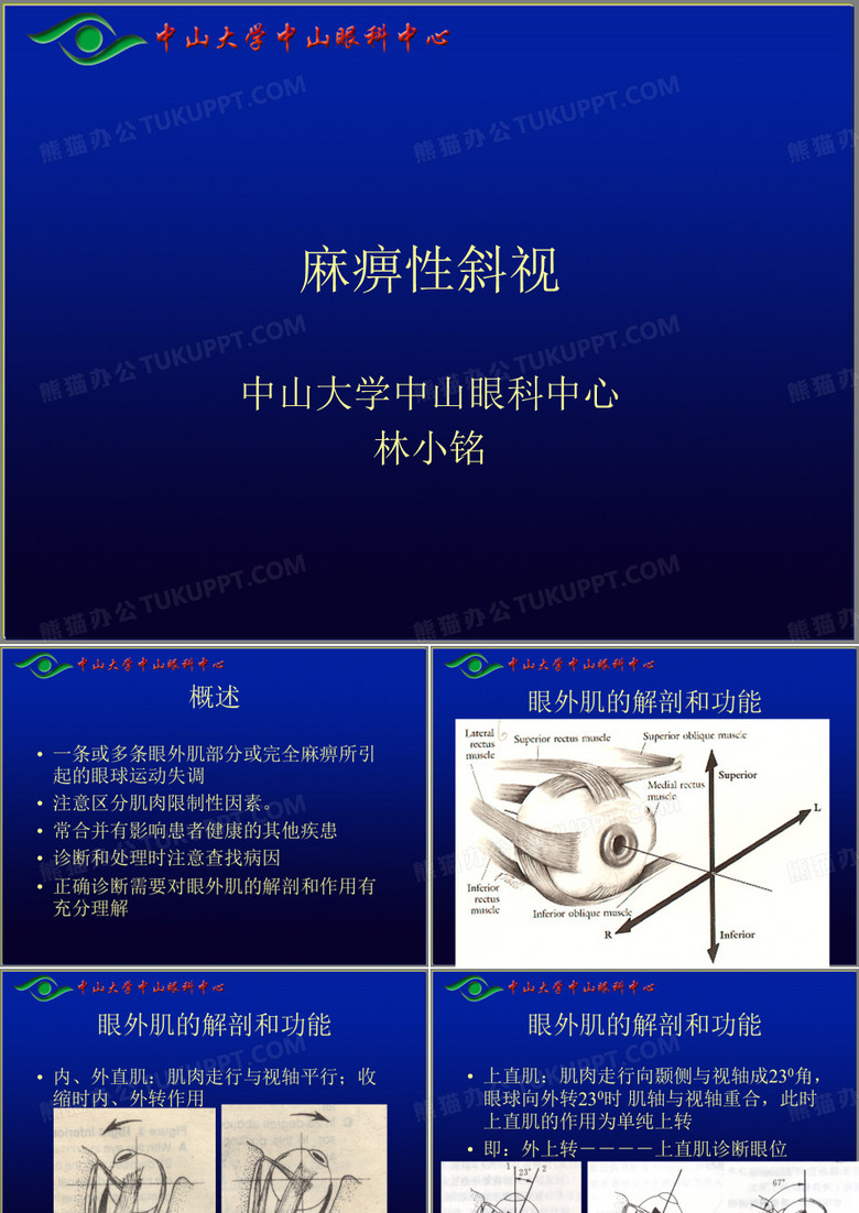 麻痹性斜视
