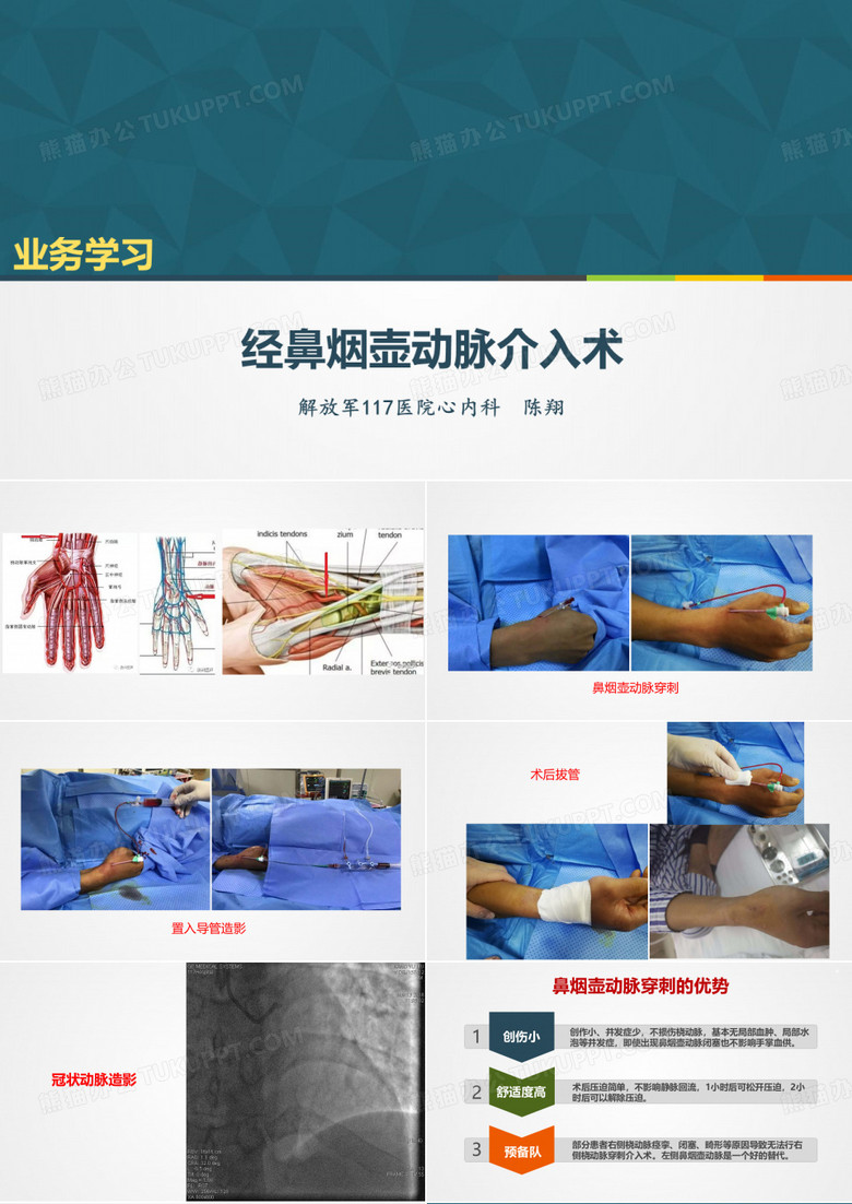 穿刺鼻烟壶动脉行冠状动脉造影术技术要点