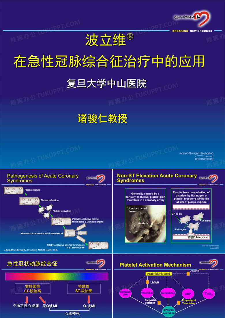 波立维在急性冠脉综合征治疗中的应用
