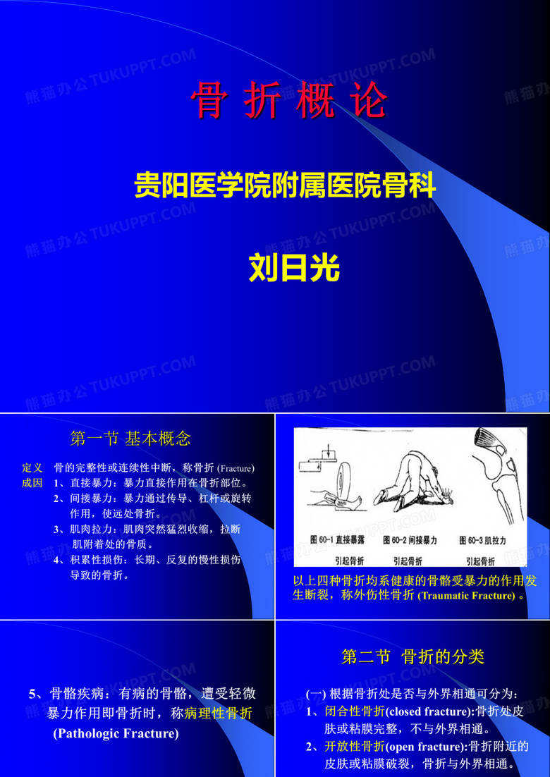 骨折概论