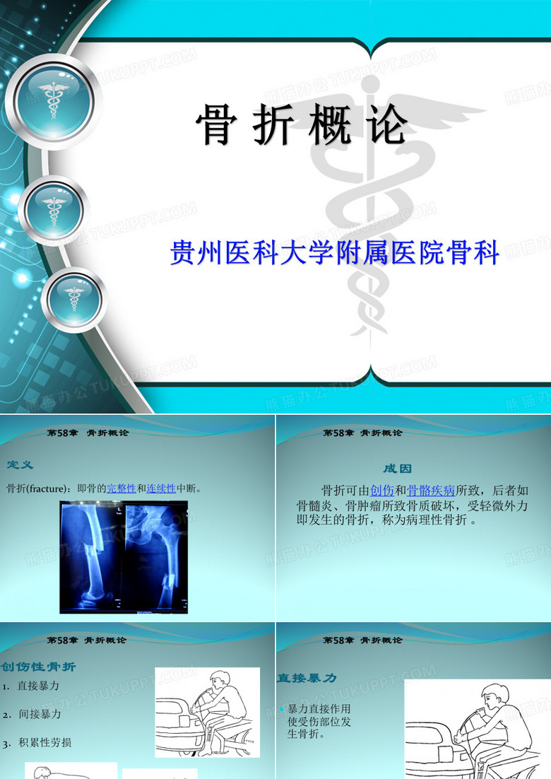 骨折概论