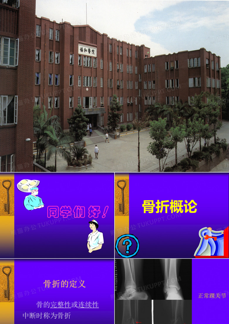 骨折概论