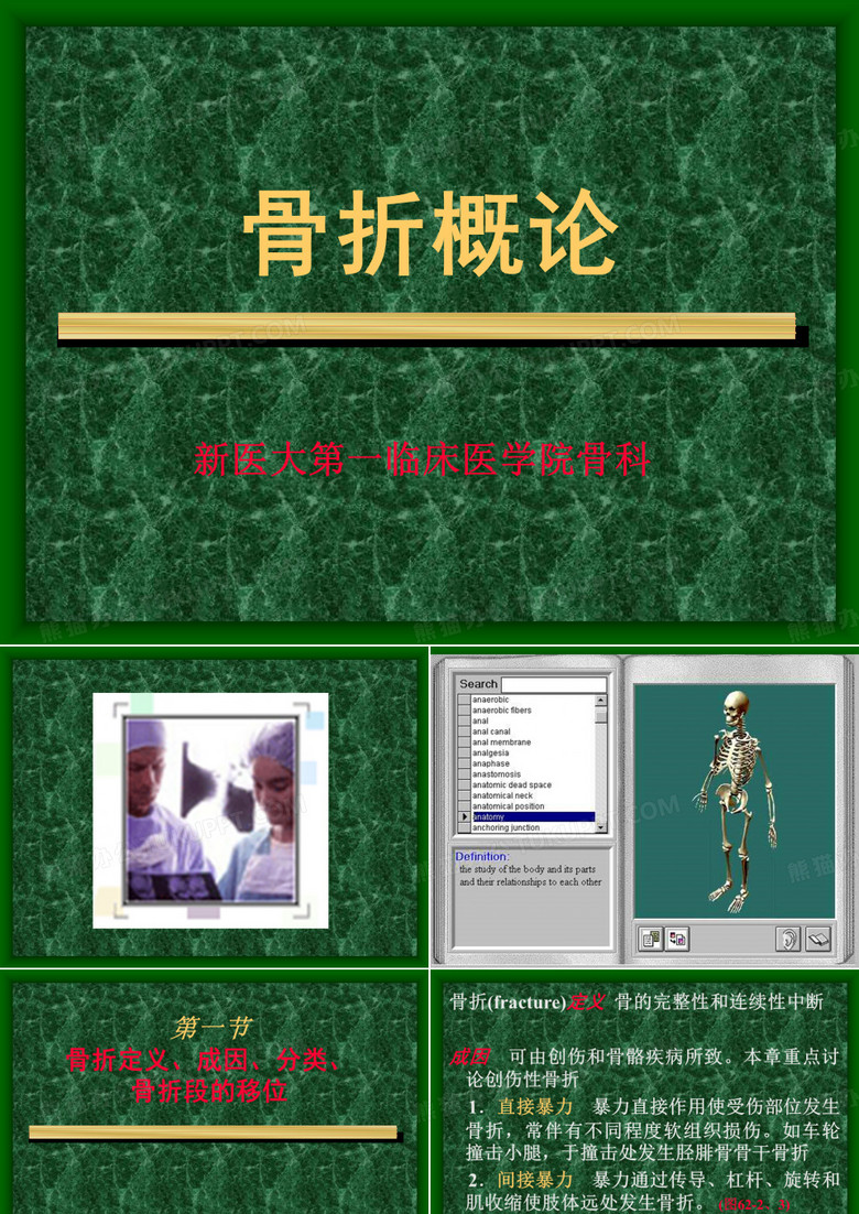 骨折概论