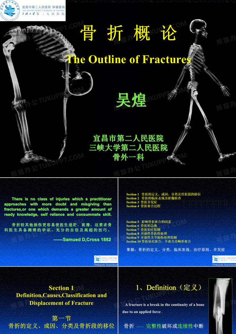 骨折概论