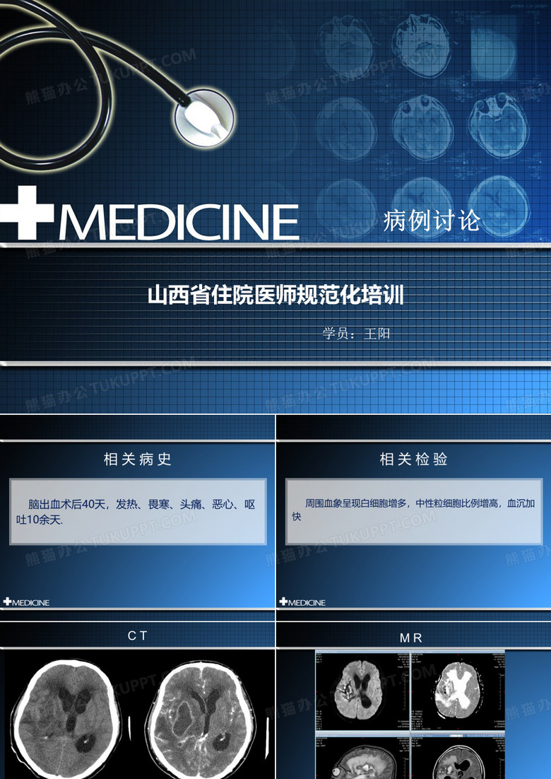 脑脓肿病例讨论