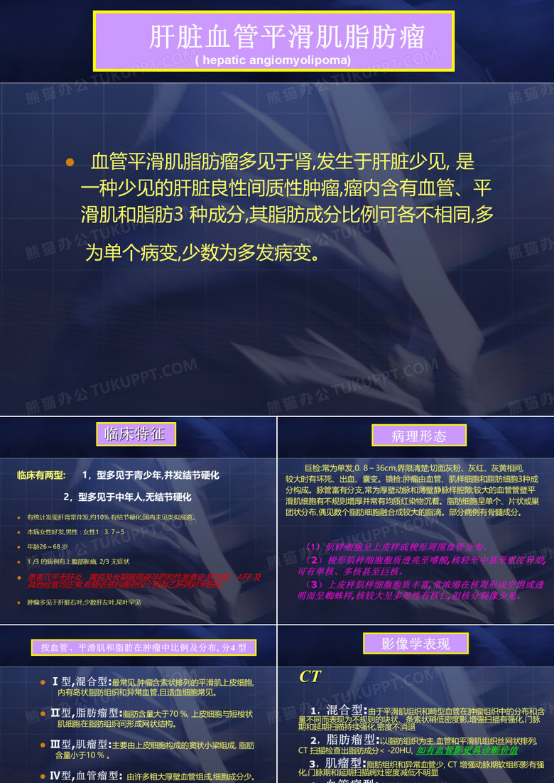肝脏血管平滑肌脂肪瘤