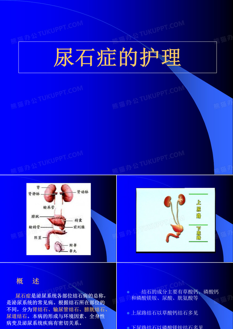 尿石症的护理