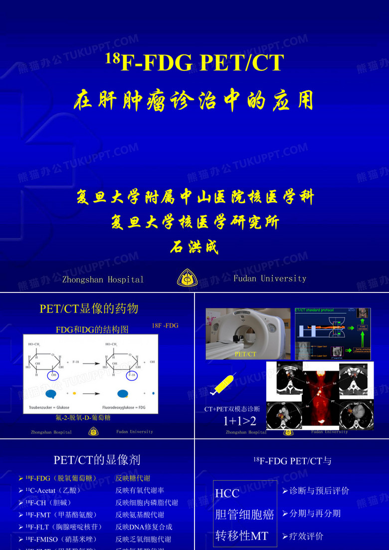 PETCT在肝肿瘤诊治中的应用2
