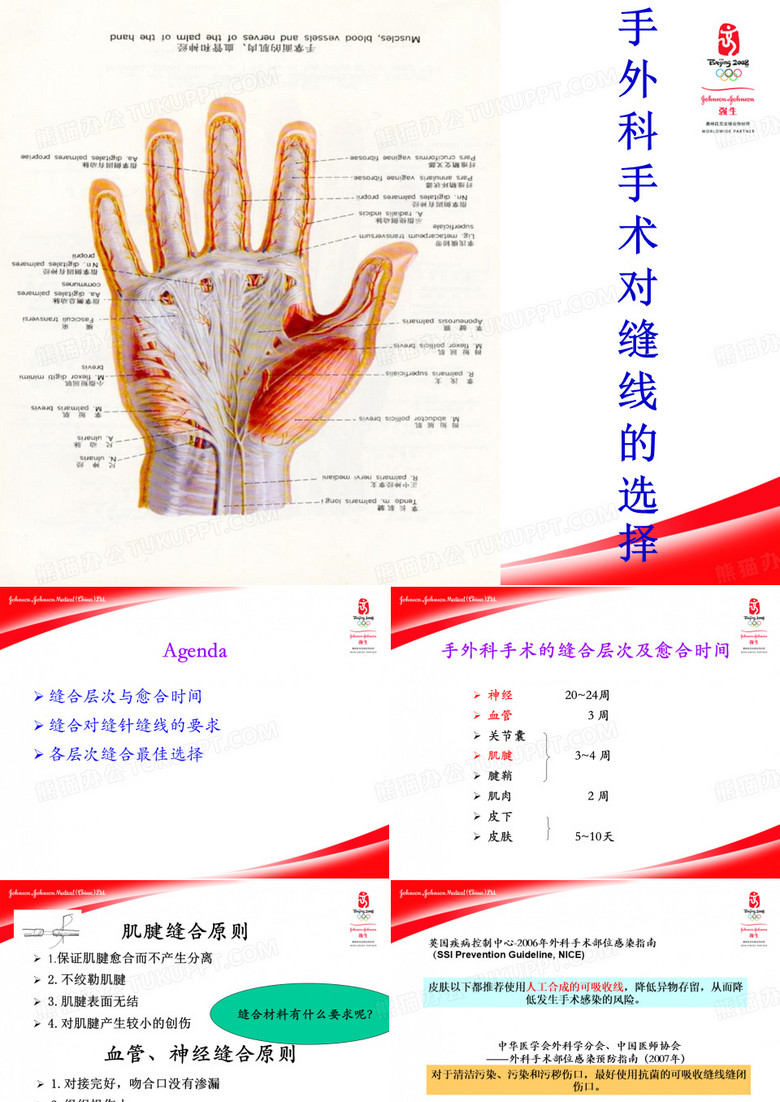 手外科缝线的选择