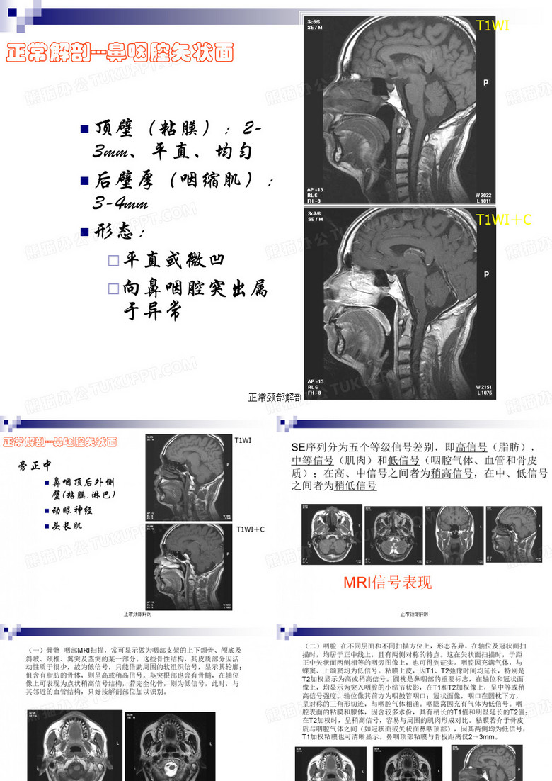 正常颈部解剖