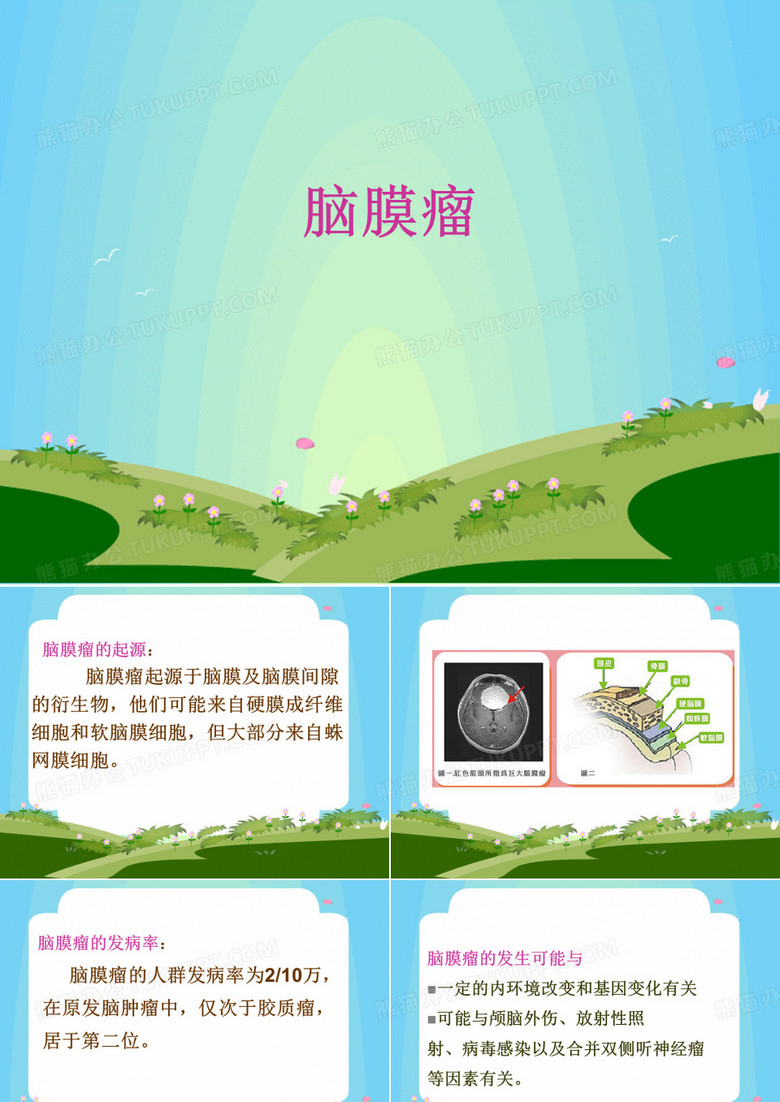 脑膜瘤