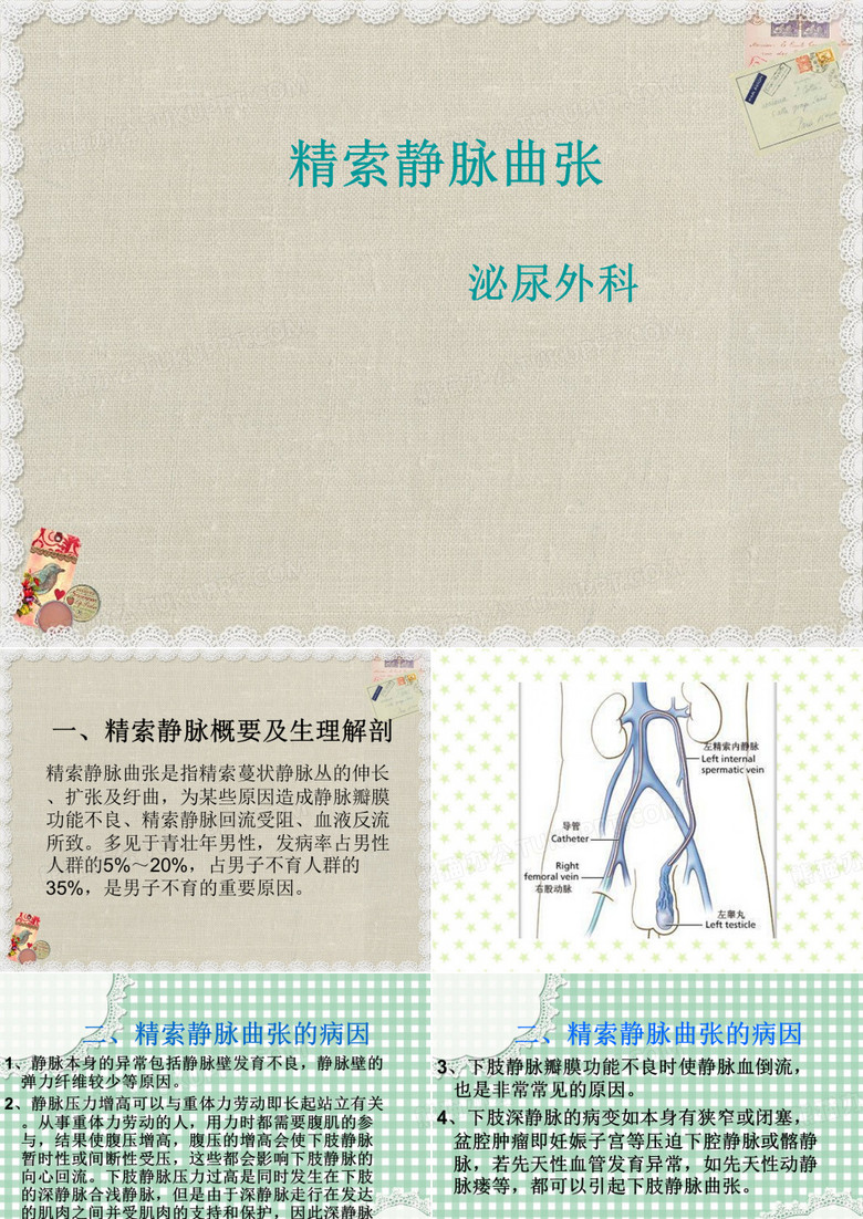 精索静脉曲张