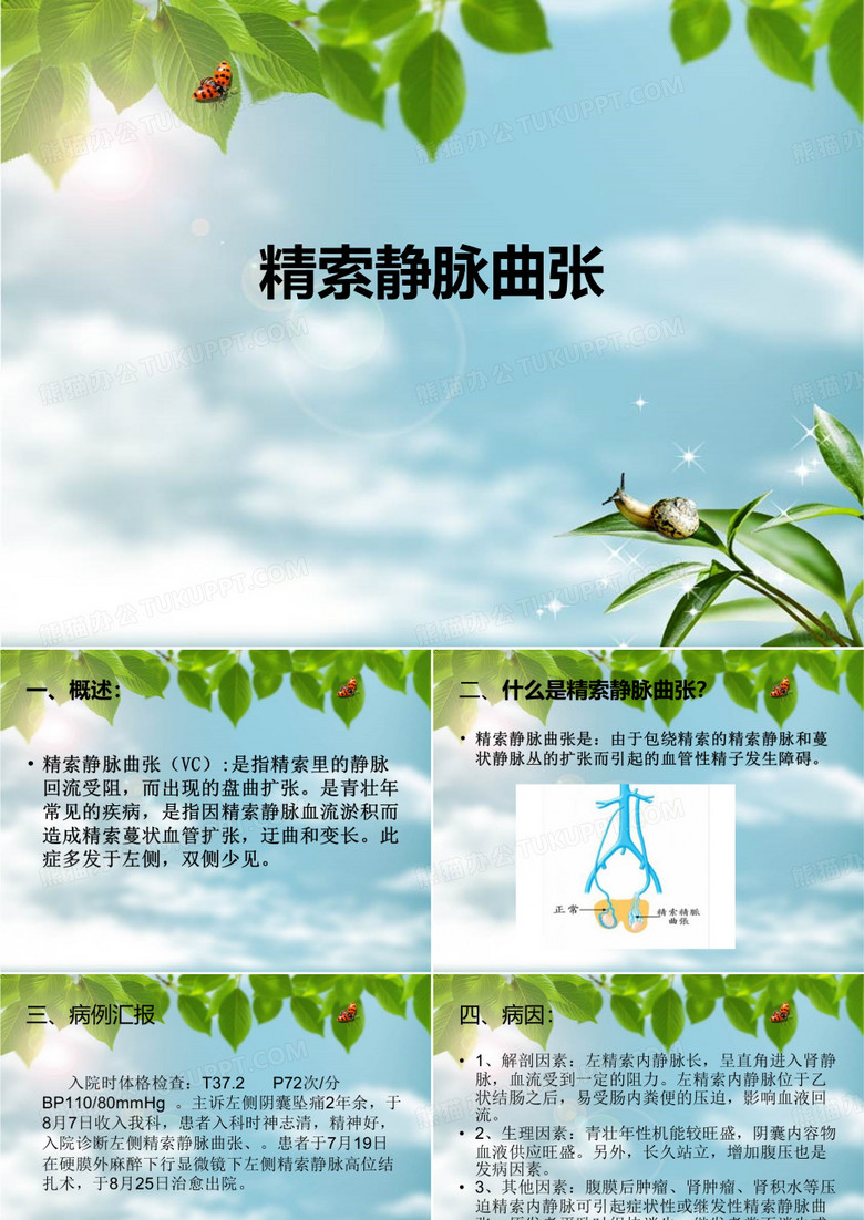 精索静脉曲张护理