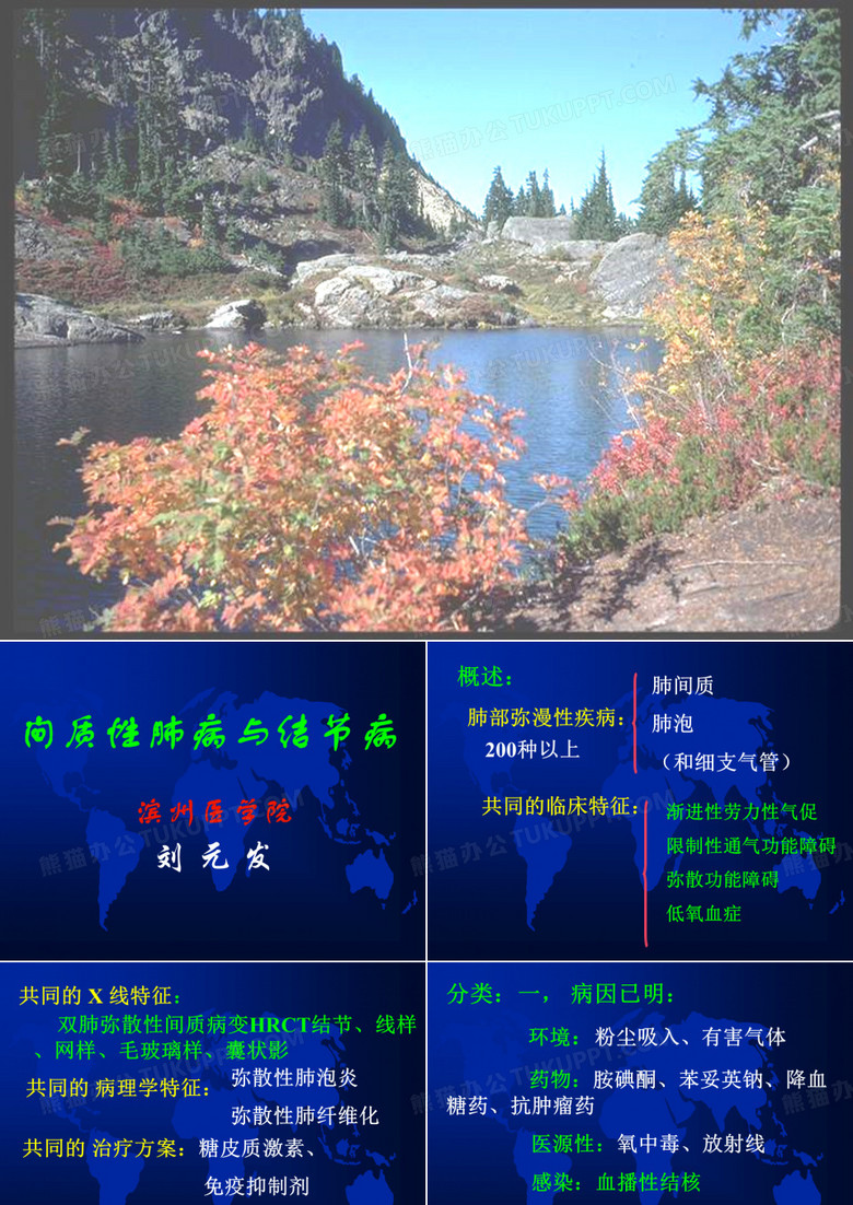 间质性肺炎