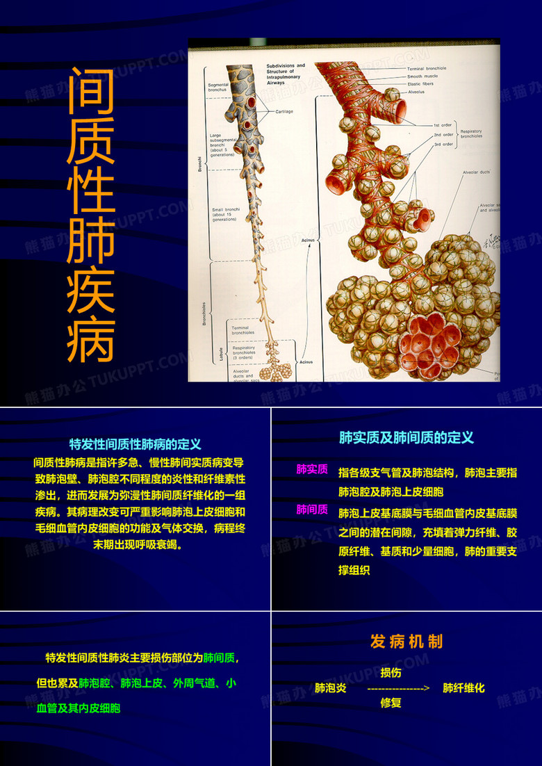 间质性肺炎