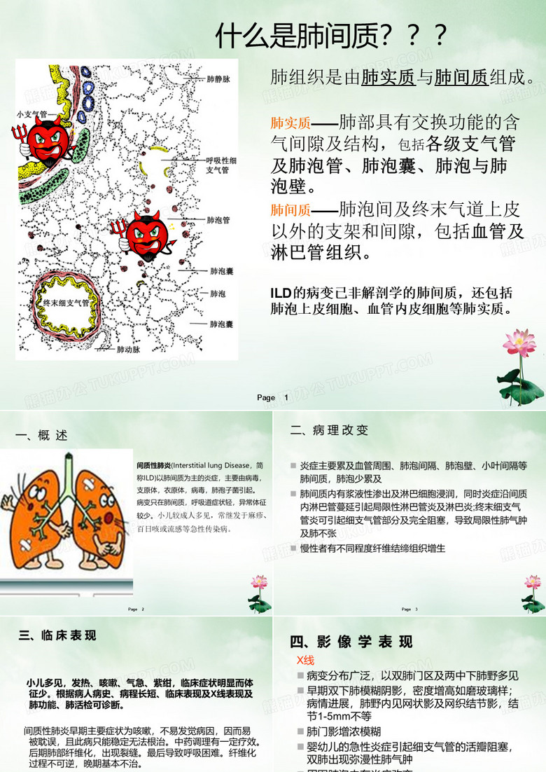 间质性肺炎ppt