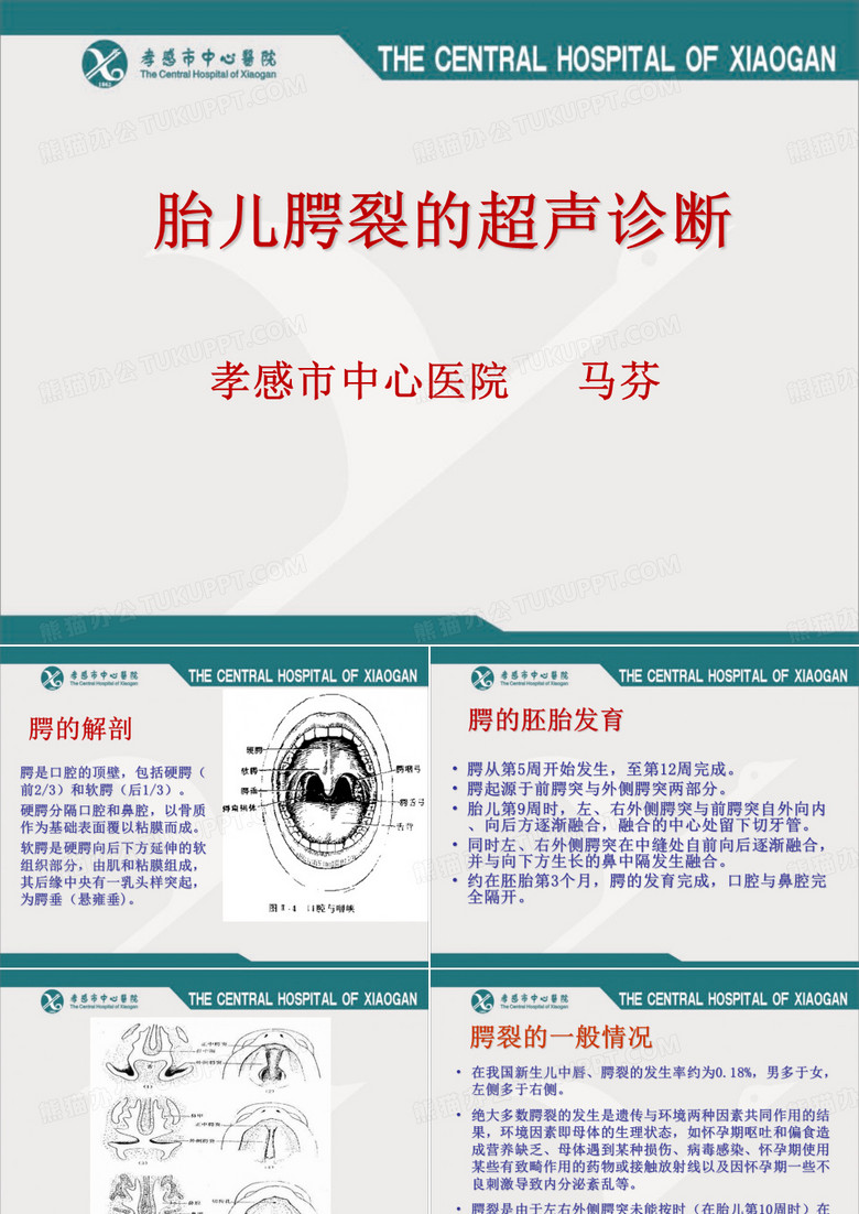 腭裂