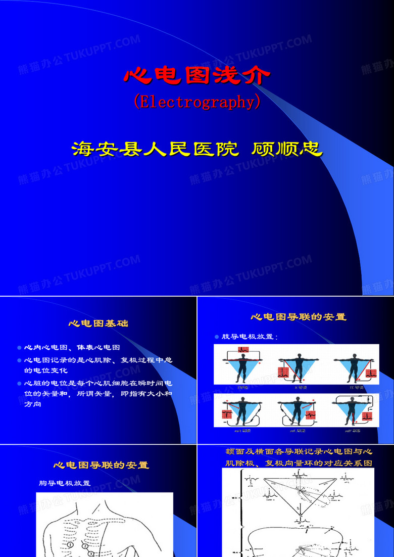 完全性RBBB右束支传导阻滞-海安人民医院