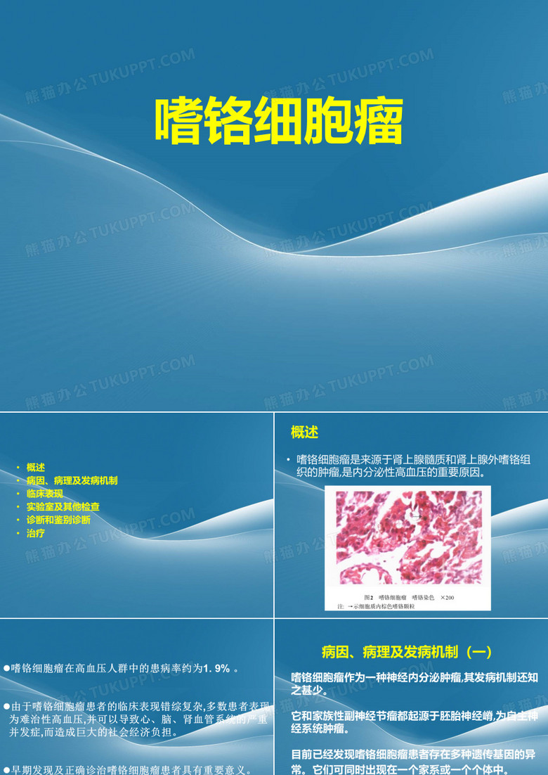 嗜铬细胞瘤