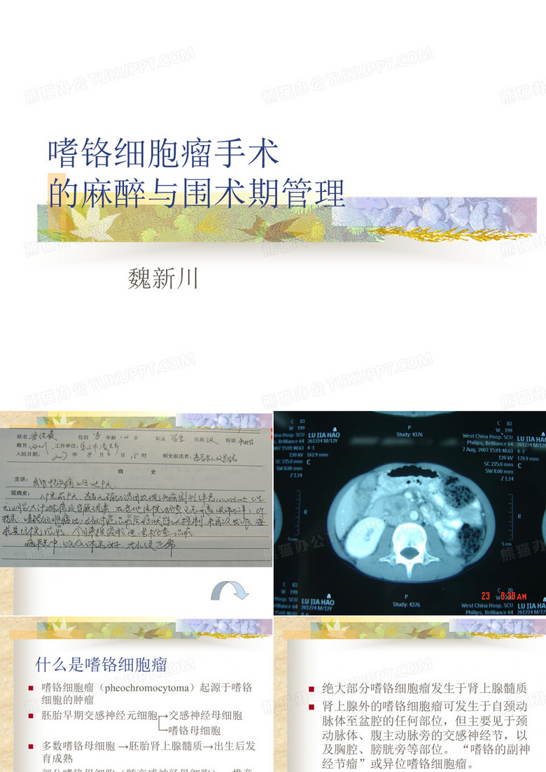 嗜铬细胞瘤麻醉