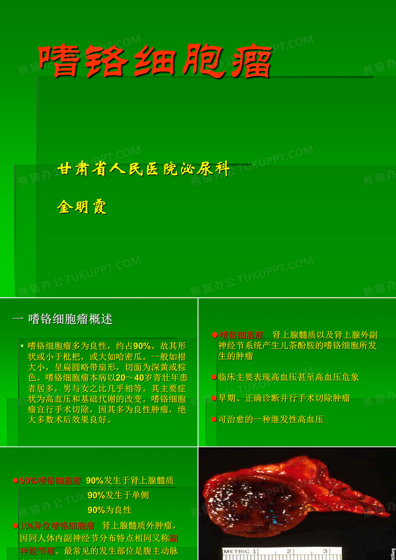 嗜铬细胞瘤幻灯