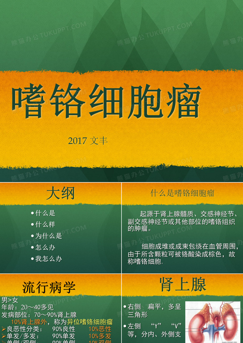 肾上腺嗜铬细胞瘤