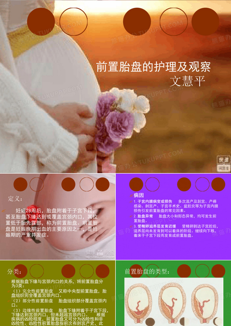前置胎盘护理模板