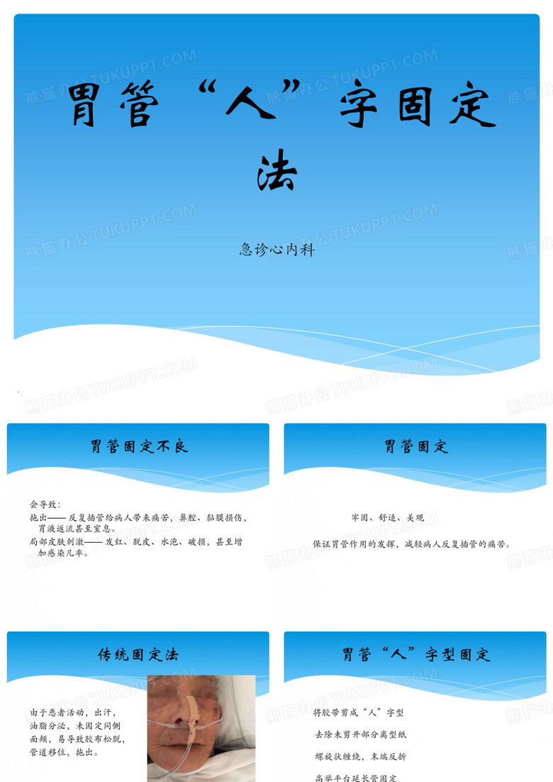 胃管固定法