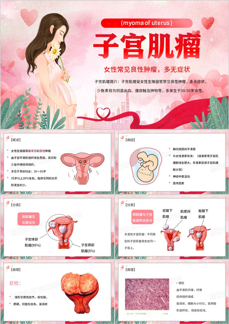 粉色卡通风子宫肌瘤PPT模板