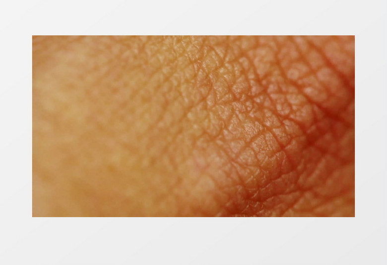 医学指关节部位的皮肤特写实拍视频