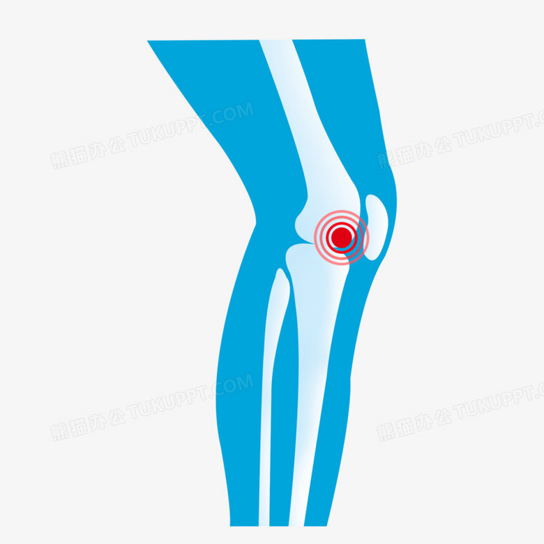膝盖骨结构彩色示意图图片