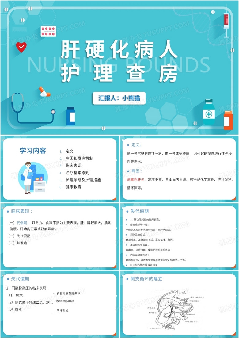 简约风蓝色肝硬化患者护理查房PPT模板