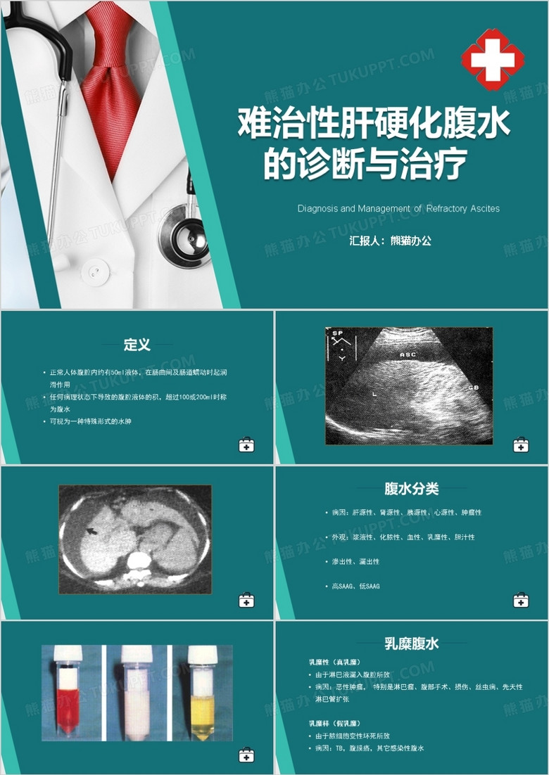 难治性肝硬化腹水的诊断与治疗PPT模板