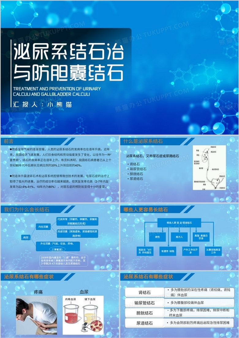 泌尿结石治与防胆囊结石护理查房PPT模板