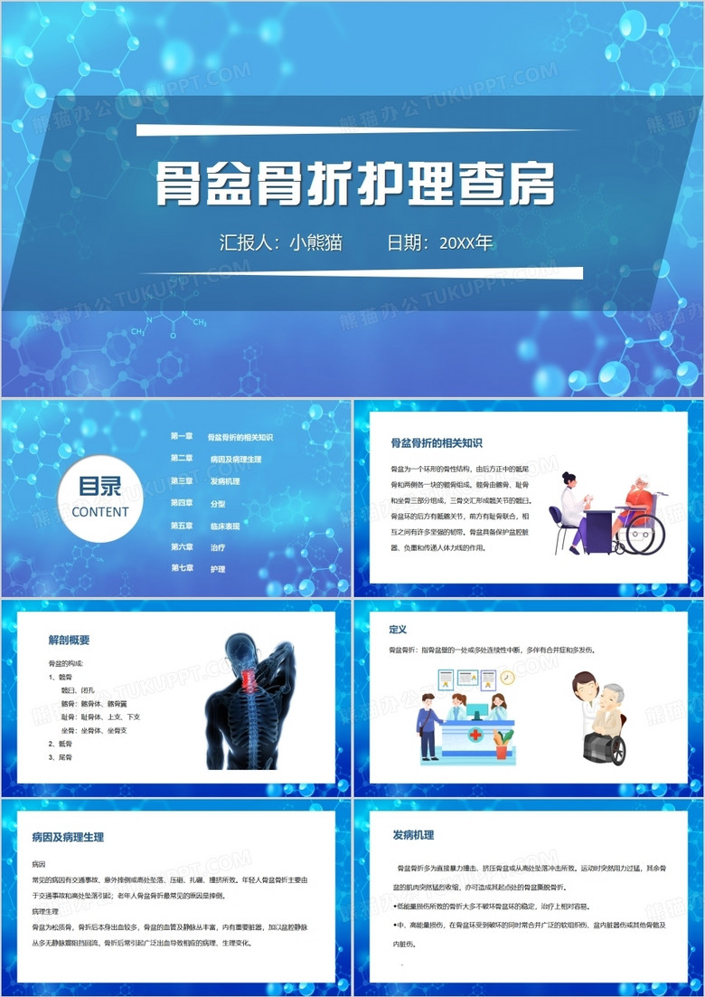 蓝色简约风多发骨盆骨折护理查房PPT模板