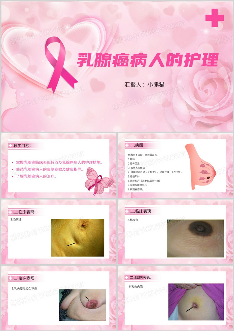 乳腺癌病人的护理PPT模板