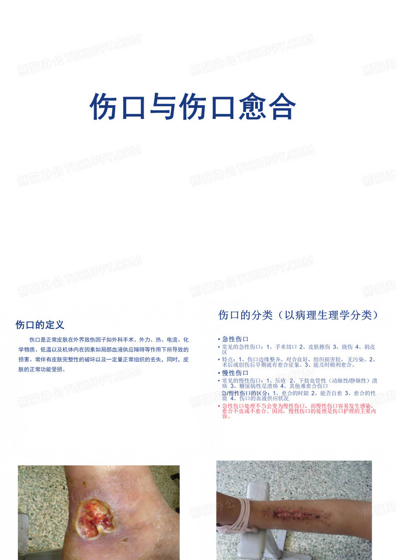 伤口与伤口愈合PPT课件
