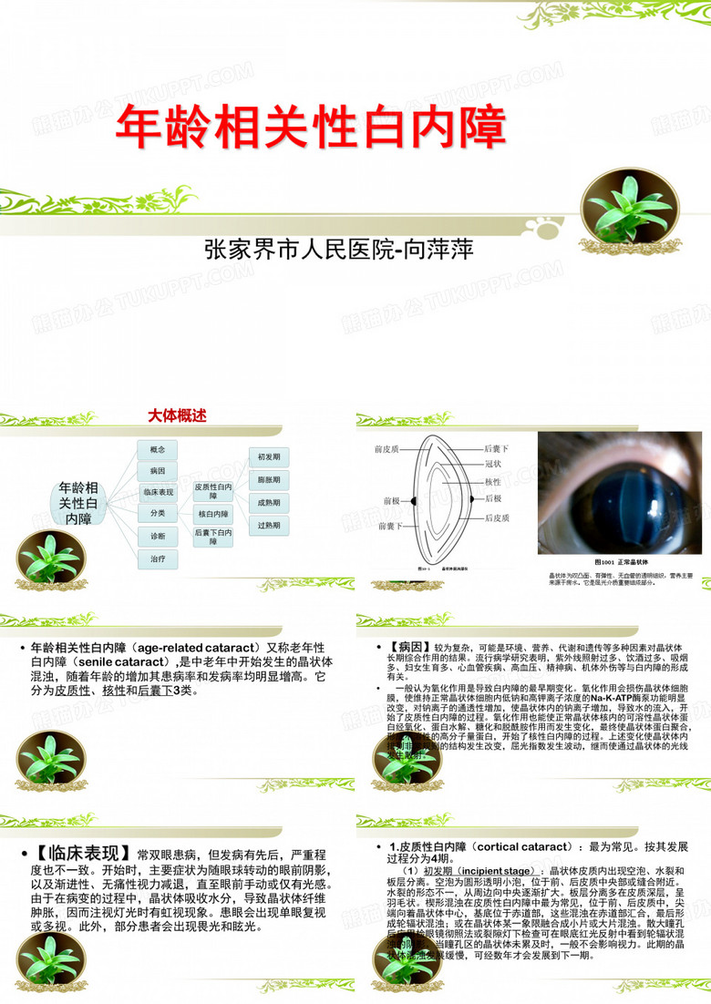 白内障