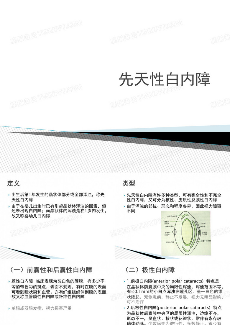 先天性白内障