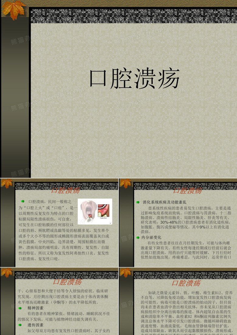 口腔溃疡 ppt课件